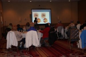 Images of Eye Anatomy at presentation